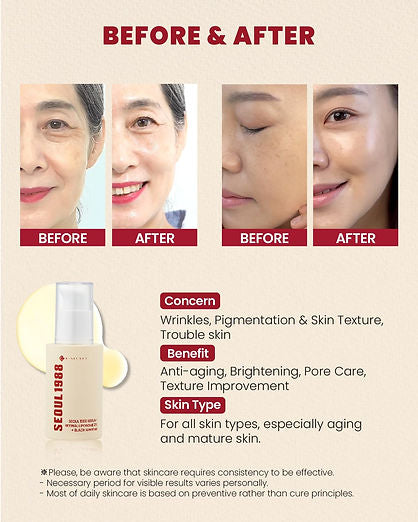 KSECRET SEOUL 1988 Sérum : liposome rétinal 2% ginseng noir, 30 ml/1,01 fl.oz | 58% d'extrait de ginseng noir | Sérum rétinal, bakuchiol, vitamine C