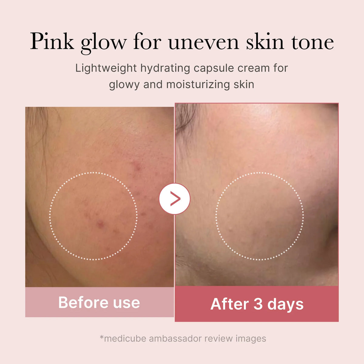 Medicube PDRN Pink Collagen Cream – Crème Hydratante Visage Légère – Niacinamide pour un Teint Irrégulier  55 g